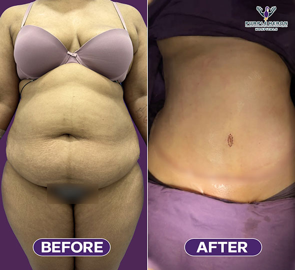 Top 10 Plastic Surgeon in Jaipur,