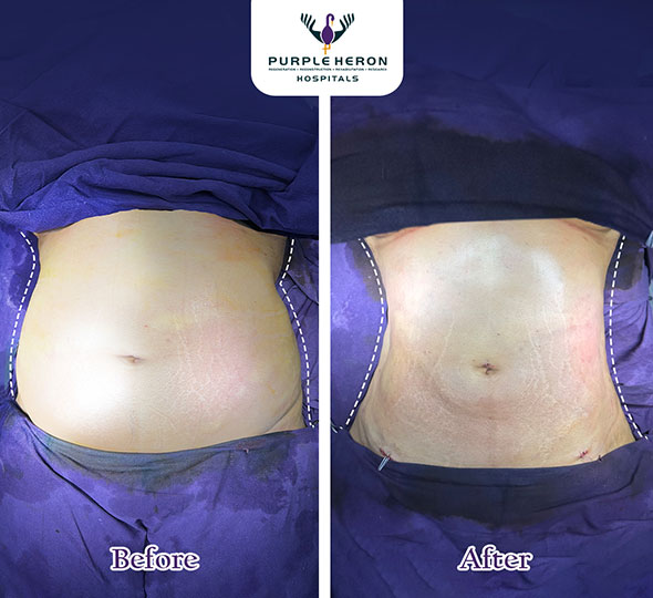 Plastic Surgeon in Jaipur