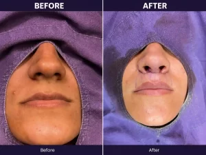 Cosmetic Surgeon in India