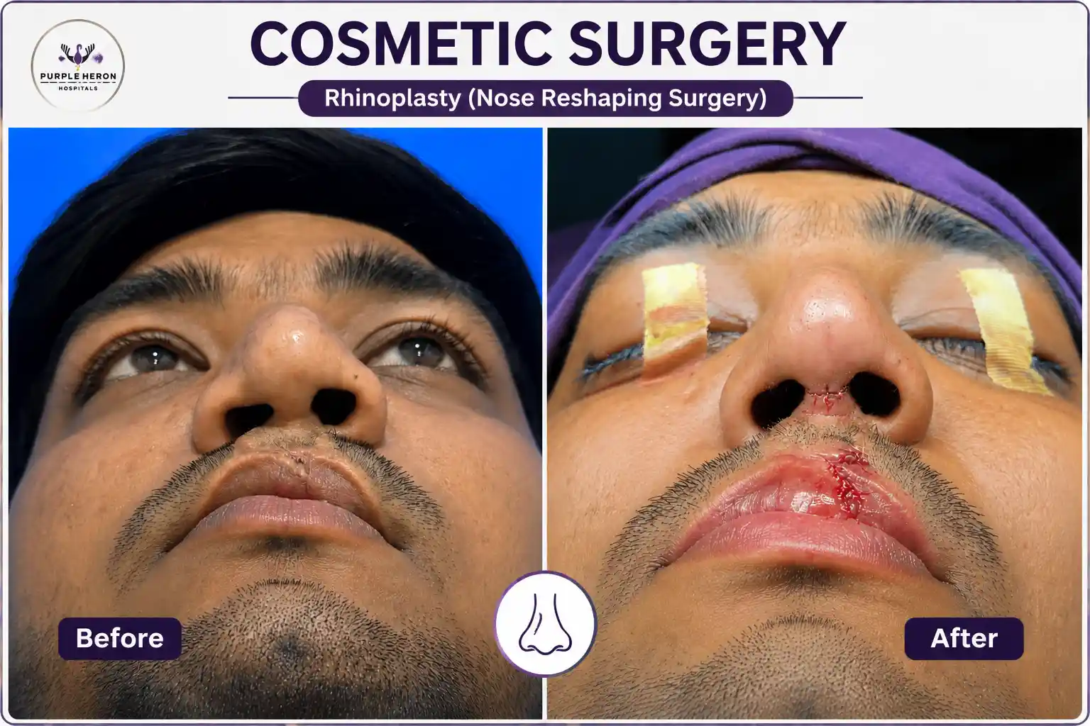 Cosmetic Surgeon in India