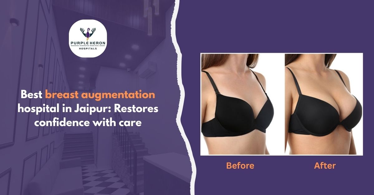 Gender Affirmation Surgery in India
