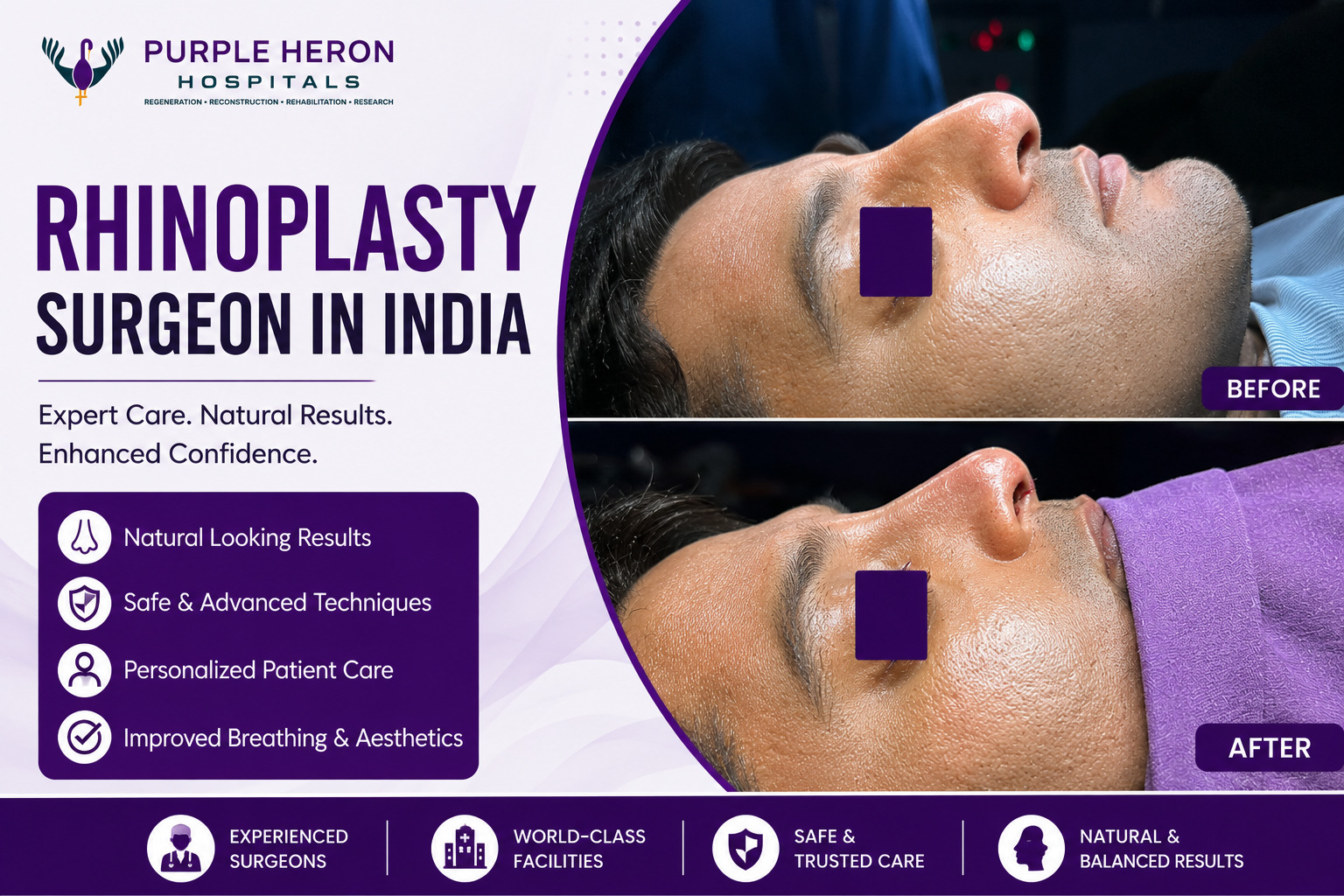 Top 10 Rhinoplasty Surgeon in India