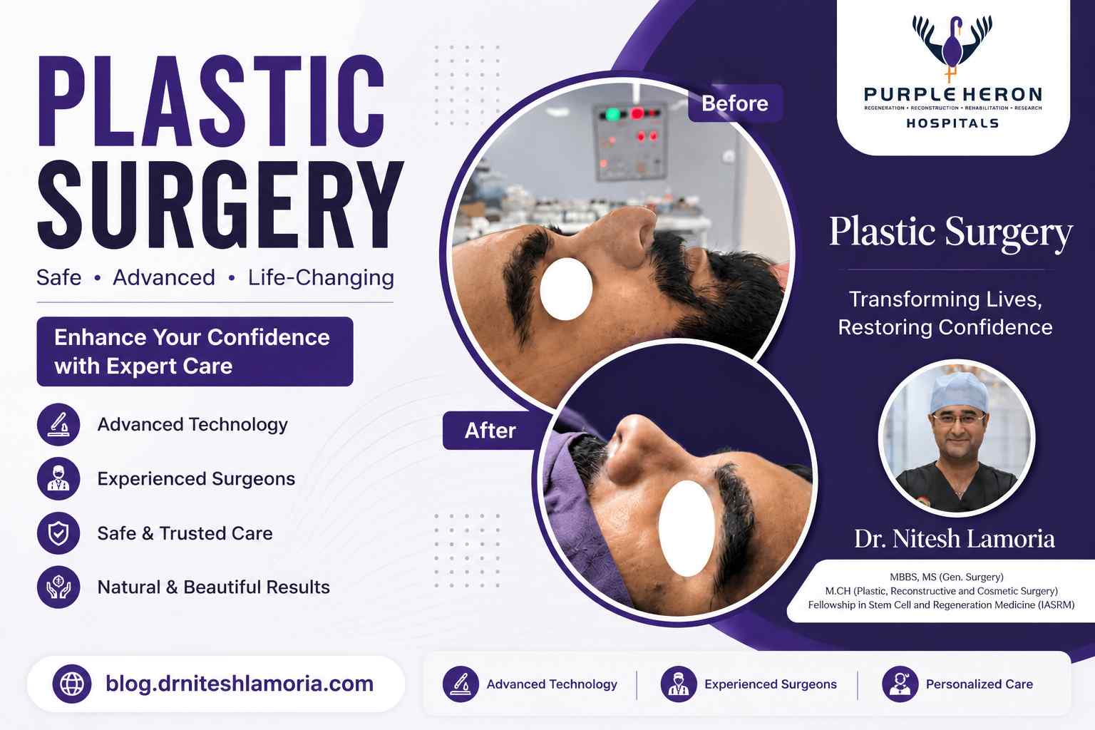 best plastic surgery hospital in India