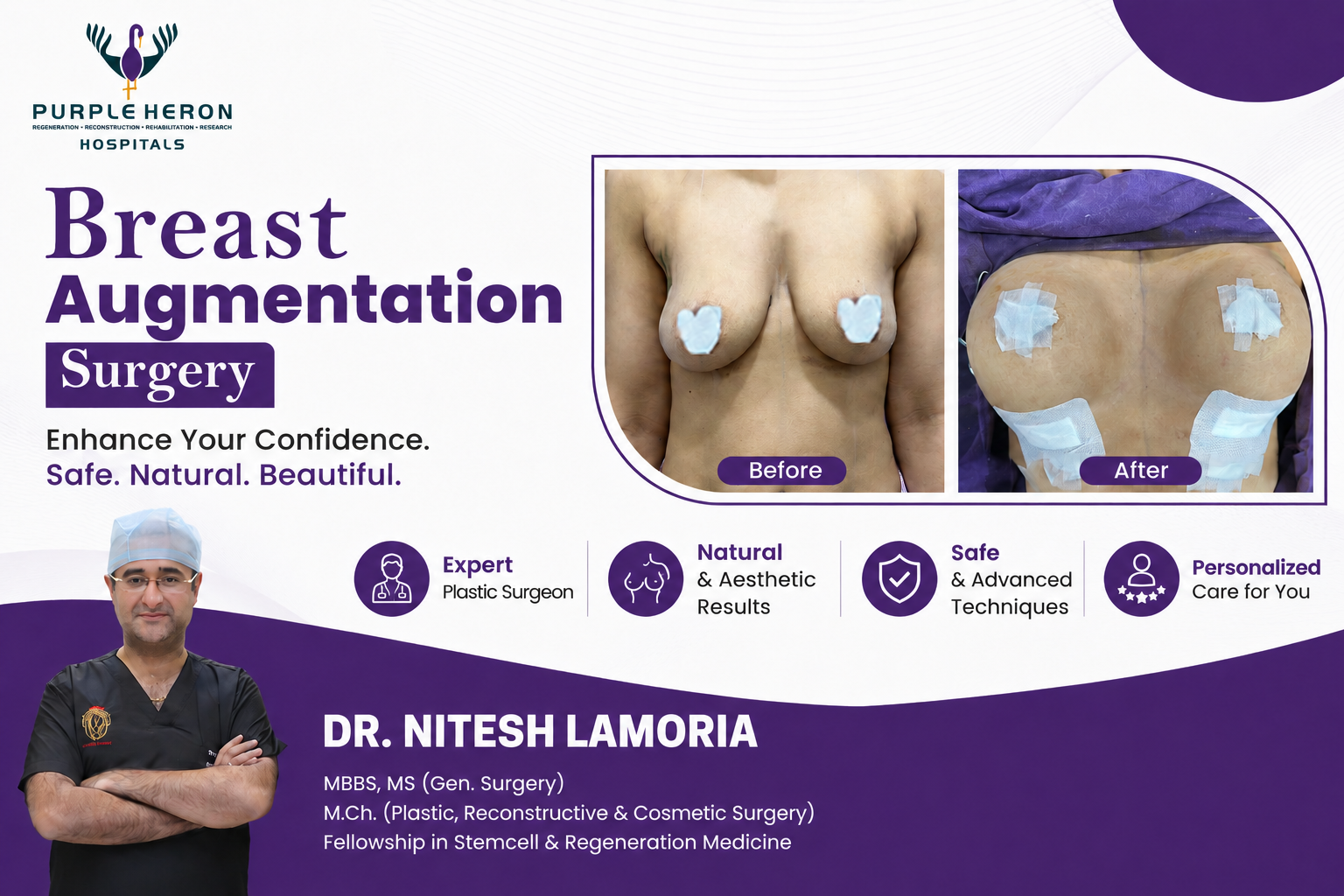 Breast Surgery in Jaipur