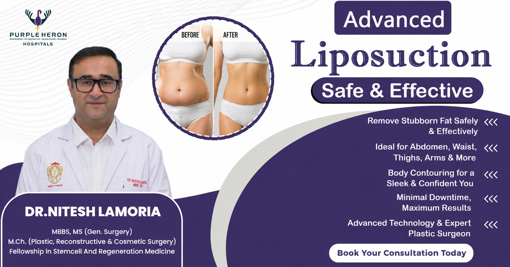 Liposuction Treatment Jaipur