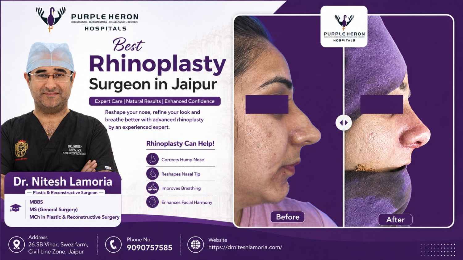 Best Rhinoplasty Surgeon in Jaipur