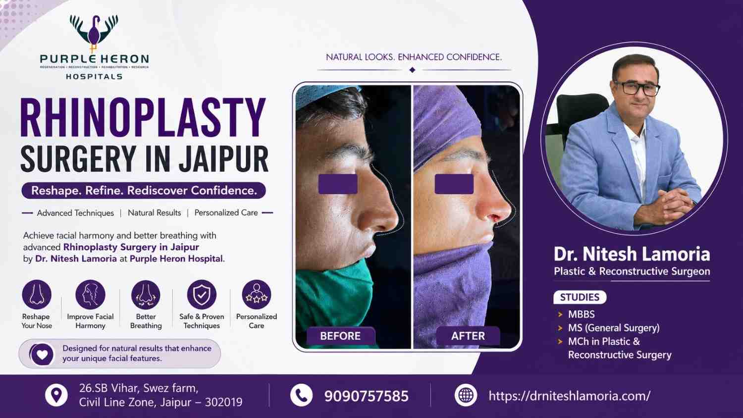 Rhinoplasty Surgery in Jaipur